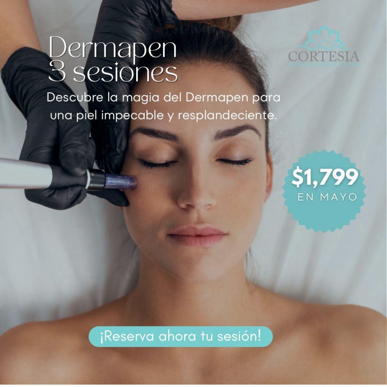Dermapen 3 Sesiones 🥇