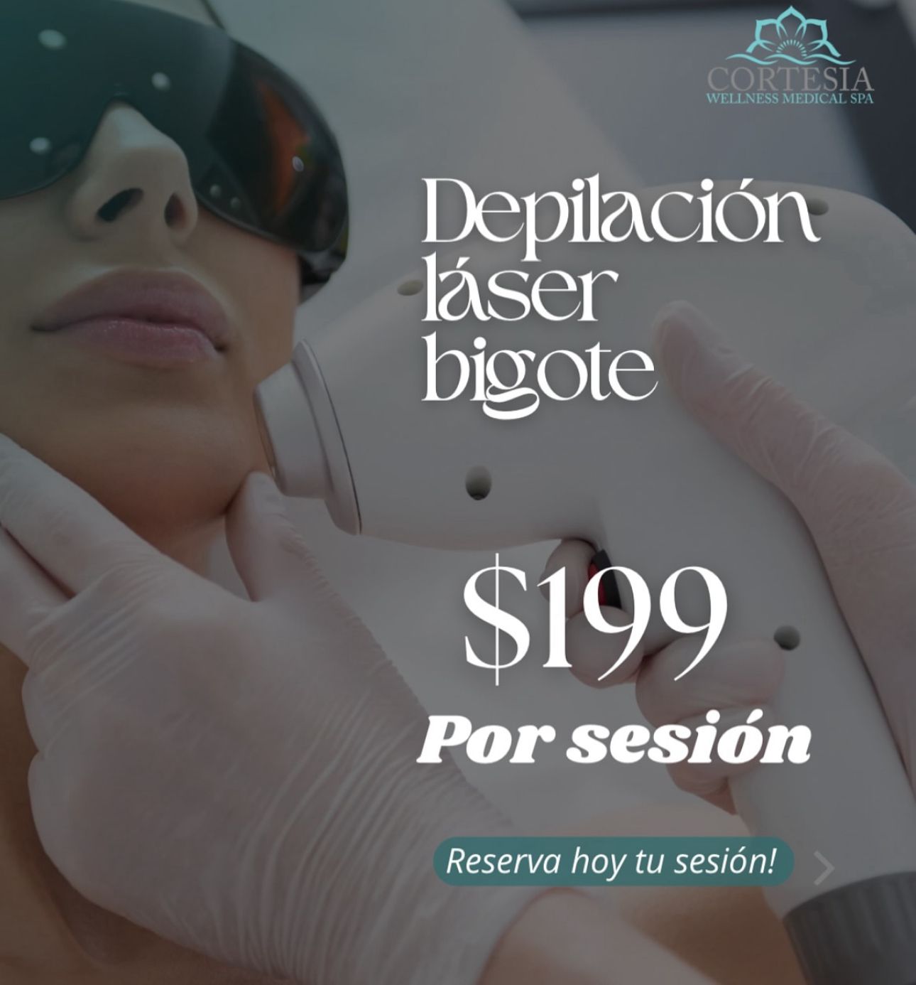 Depilación Laser en Bigote