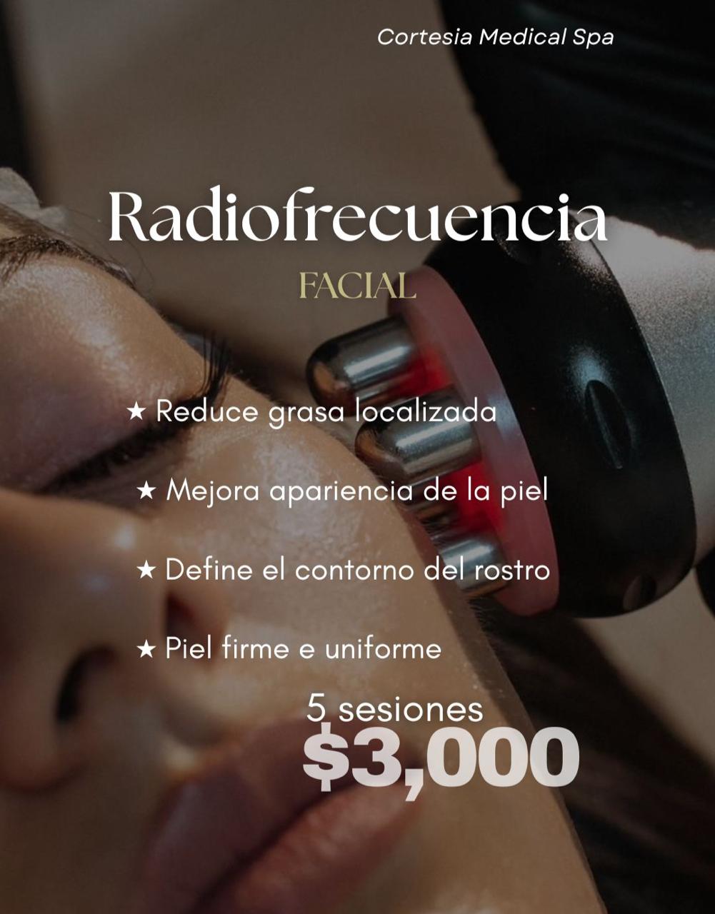 Radiofrecuencia Facial ( 5 sesiones)