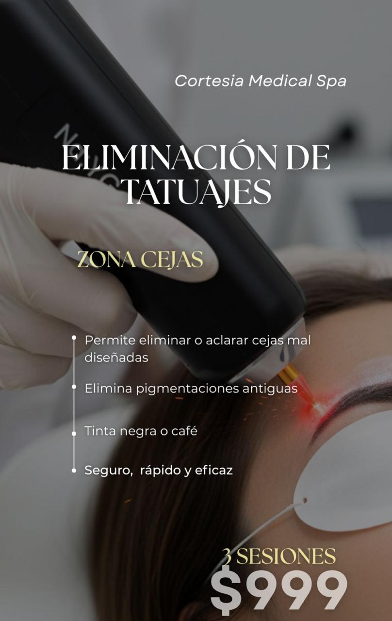Eliminación de Tatuajes en Cejas