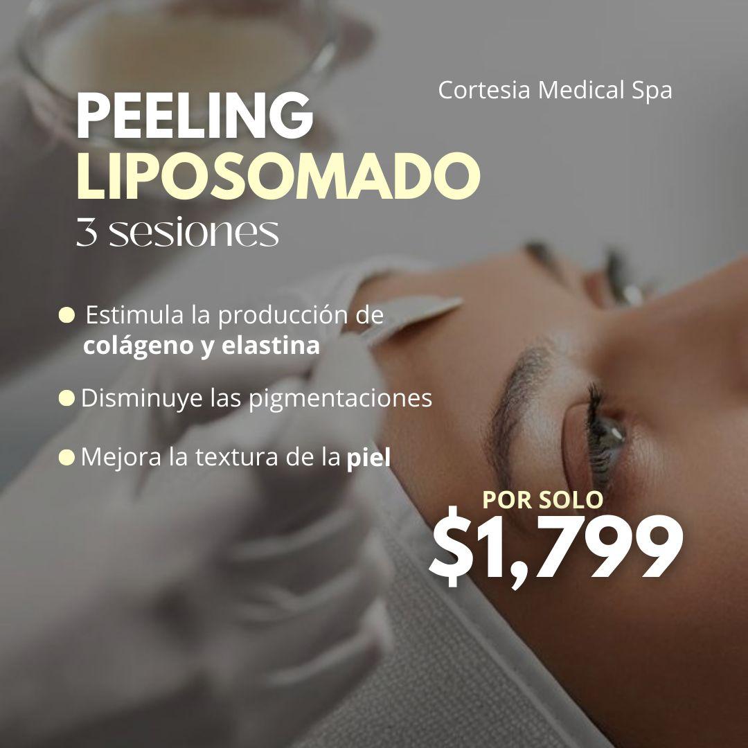 Peeling Liposomado ( 3 sesiones)