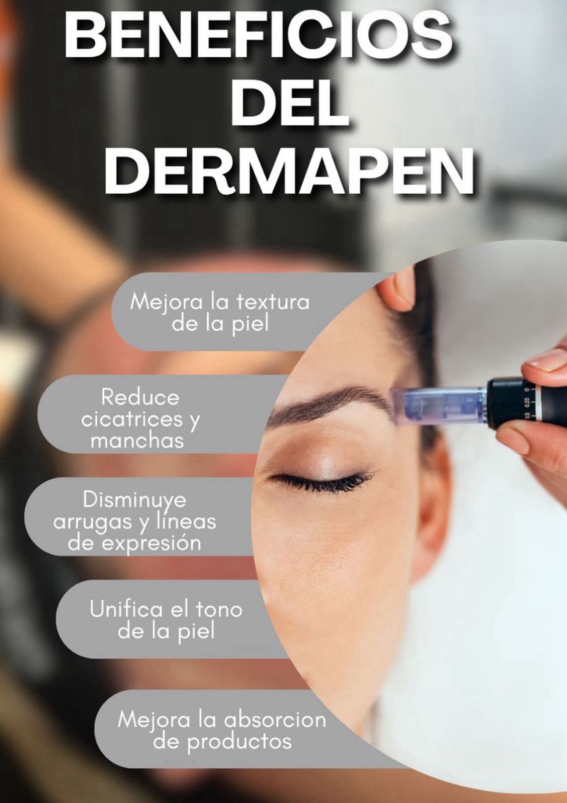 Dermapen 3 Sesiones 🥇